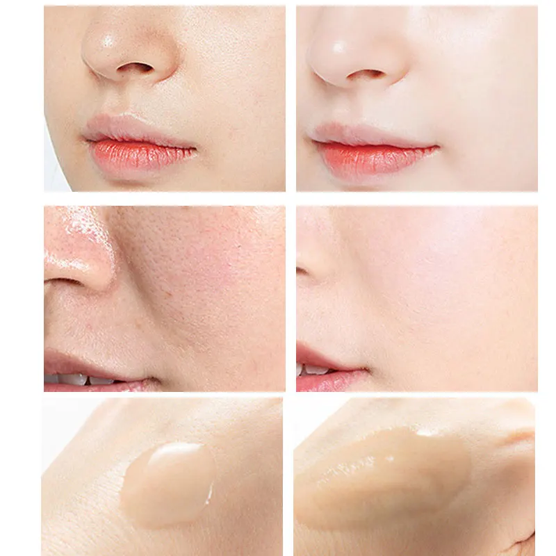 Soyma Serum salisilik asit yüz - Niacinamide Pore Shrinking Essence incelemesi ve fiyatı